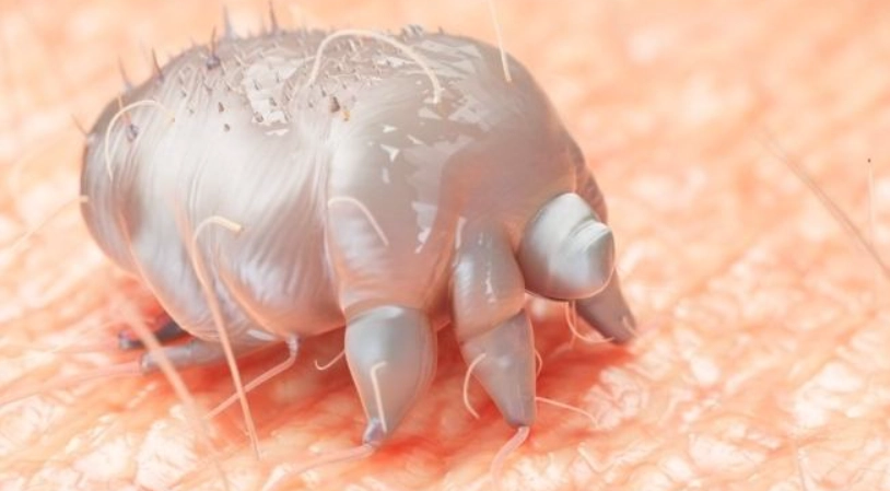 疥蟲怕漂白水嗎？專家解析有效消毒步驟與常見錯誤