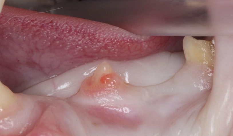 貓咪牙齒吸收症狀