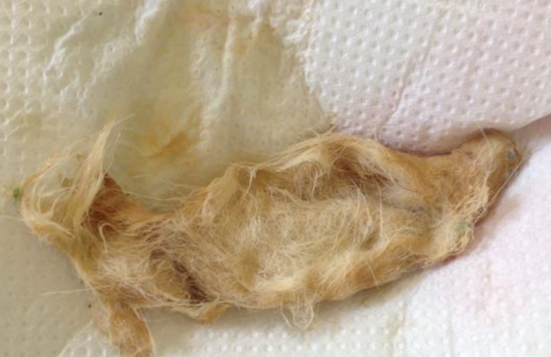 貓咪吐毛球顏色代表什麼？5種顏色解析與改善對策