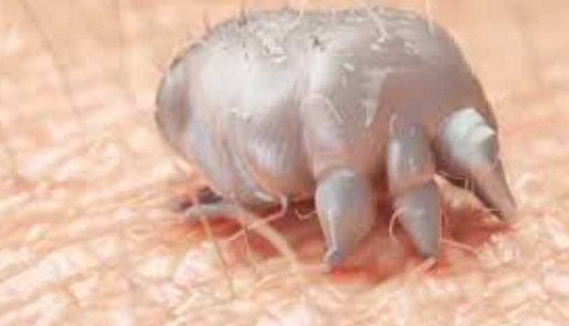 為什麼會有疥蟲？完整解析疥蟲來源與預防方法