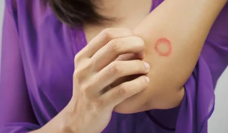 貓病傳染人 貓病傳染人