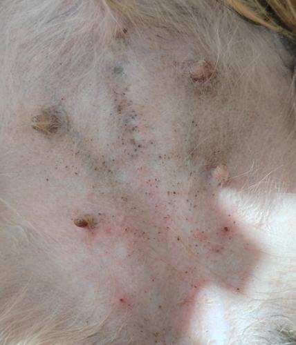 毛囊炎會傳染嗎