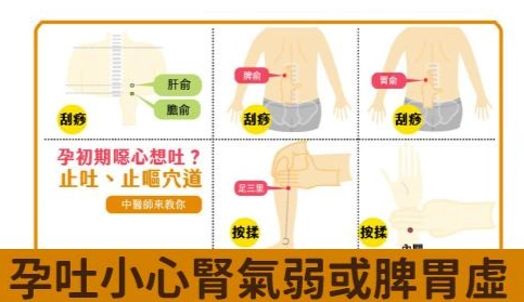 懷孕嘔吐穴位按摩