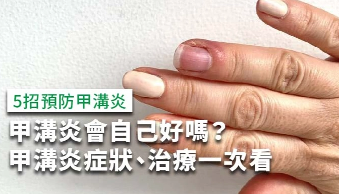 指間炎治療期間