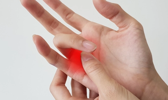 指間炎康復時間