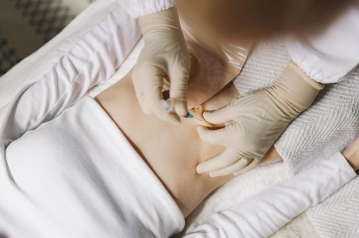 瘦瘦針使用時間