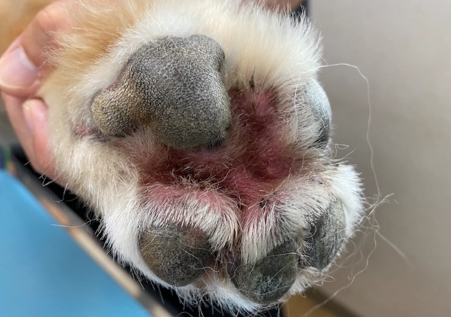 趾間炎腫瘤治療