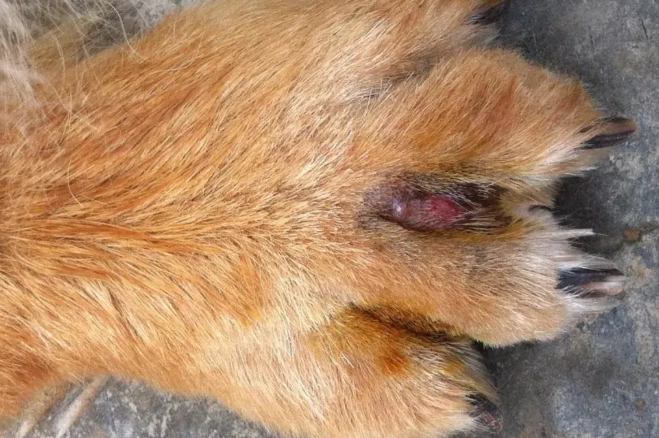 趾間炎腫瘤治療