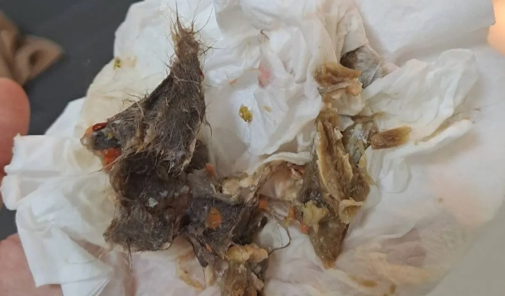 毛球症治療方法