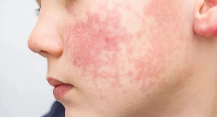 细小病毒传播途径