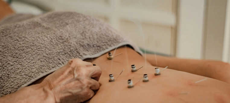 艾灸治療中醫