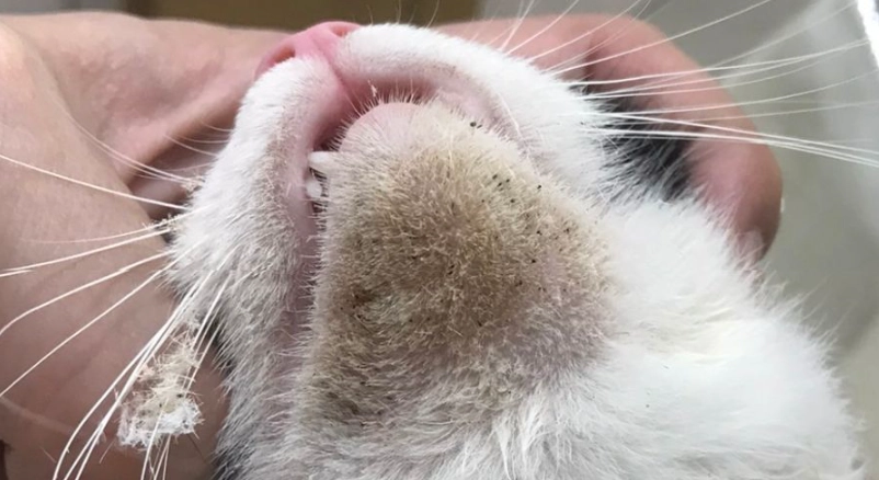 貓下巴黑頭粉刺